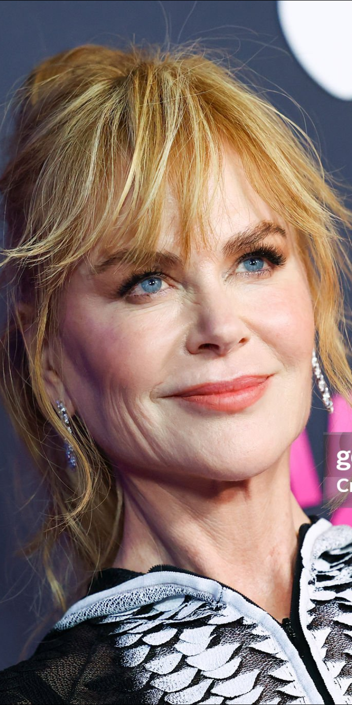 줄기세포 맞았다는 니콜 키드먼 근황