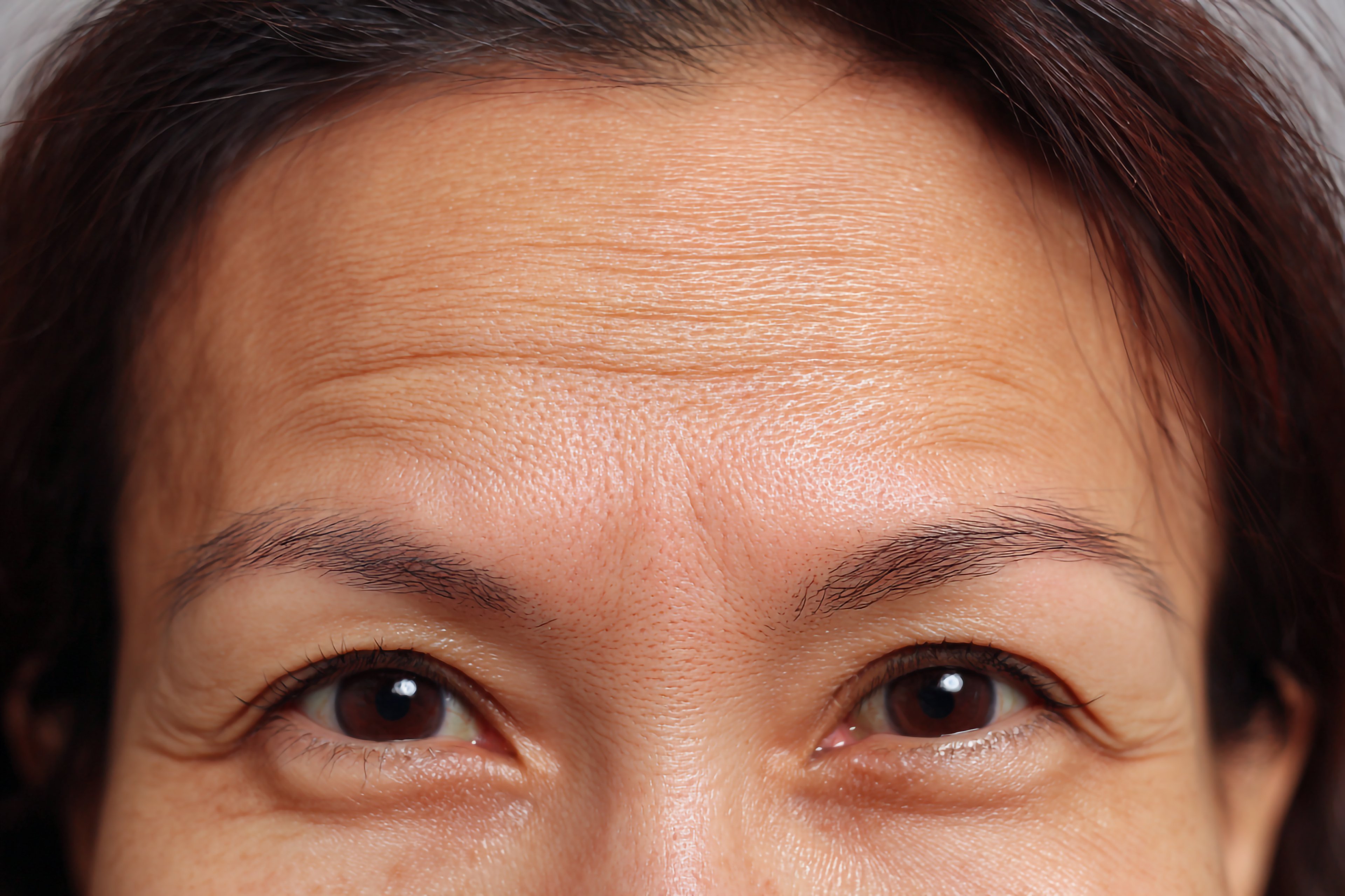 Screen Habits and Forehead Aging: What the Research Suggests — cover image