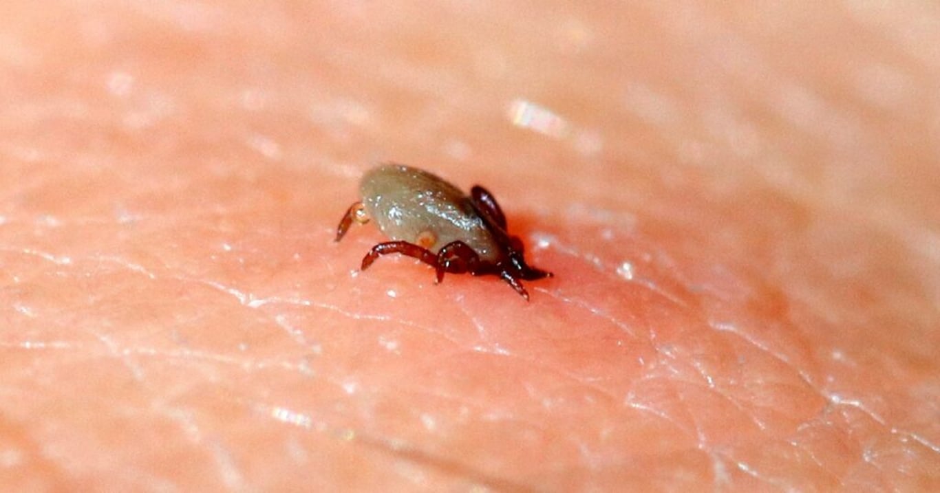 Díky tomuto bleskurychlému triku na odstranění klíštěte se vyhnete zdravotním rizikům