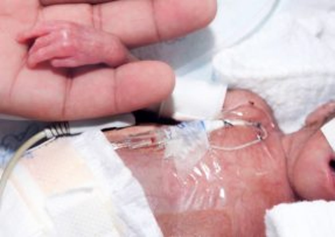 předčasně narozené dítě