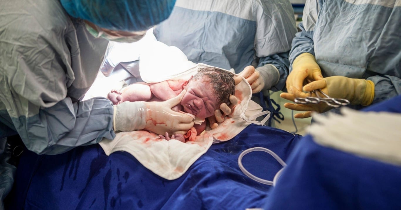 Vzácný případ dvojčat: Jedno se vyvíjelo přímo v hlavě toho druhého. Nad tím, jak dlouho tam žilo, lékaři kroutí hlavou