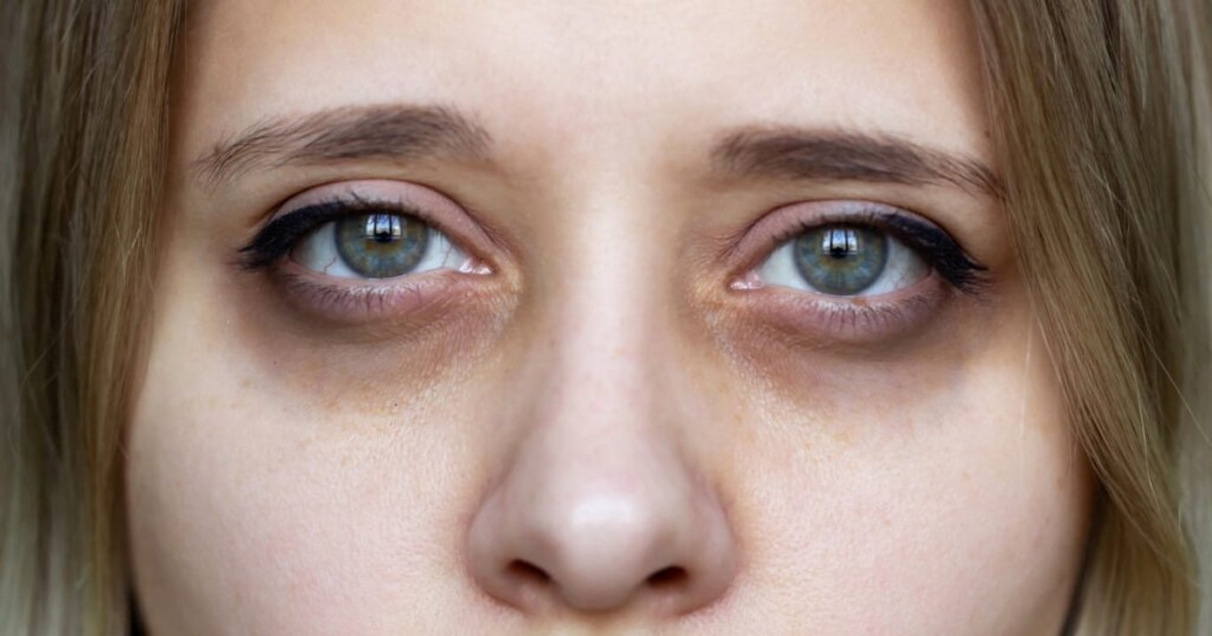 Dlouho nevěděla, proč jí věčně bolela hlava a nemohla spát. Trpěla nedostatkem tohoto minerálu