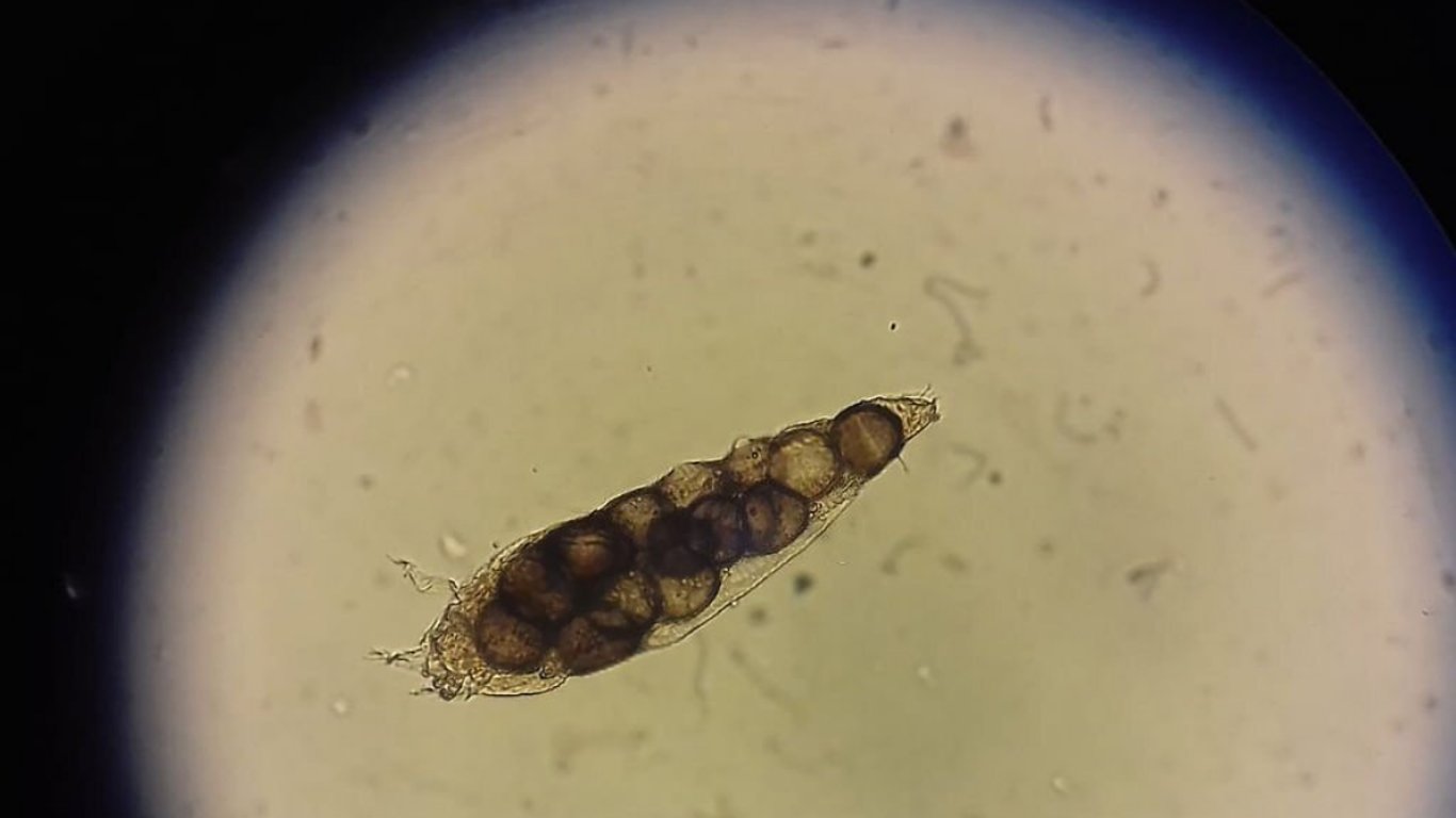 Lidské tělo dokáže zázraky, ale i věci, které děsí. Tyhle zvláštnosti dokazují, jak podivní vlastně jsme