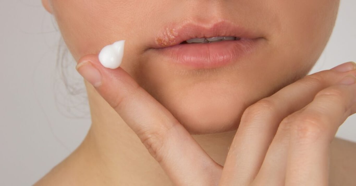 Virus herpes nejčastěji způsobuje vážné zdravotní následky kvůli přehlížení těchto příznaků