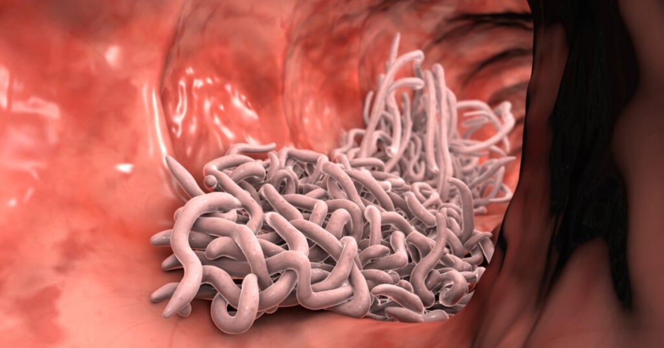 Střevní parazity lze odhalit pomocí typických příznaků