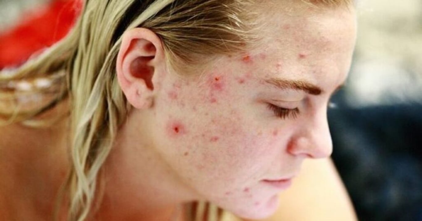 Za těmito častými zdravotními problémy stojí hormonální nerovnováha