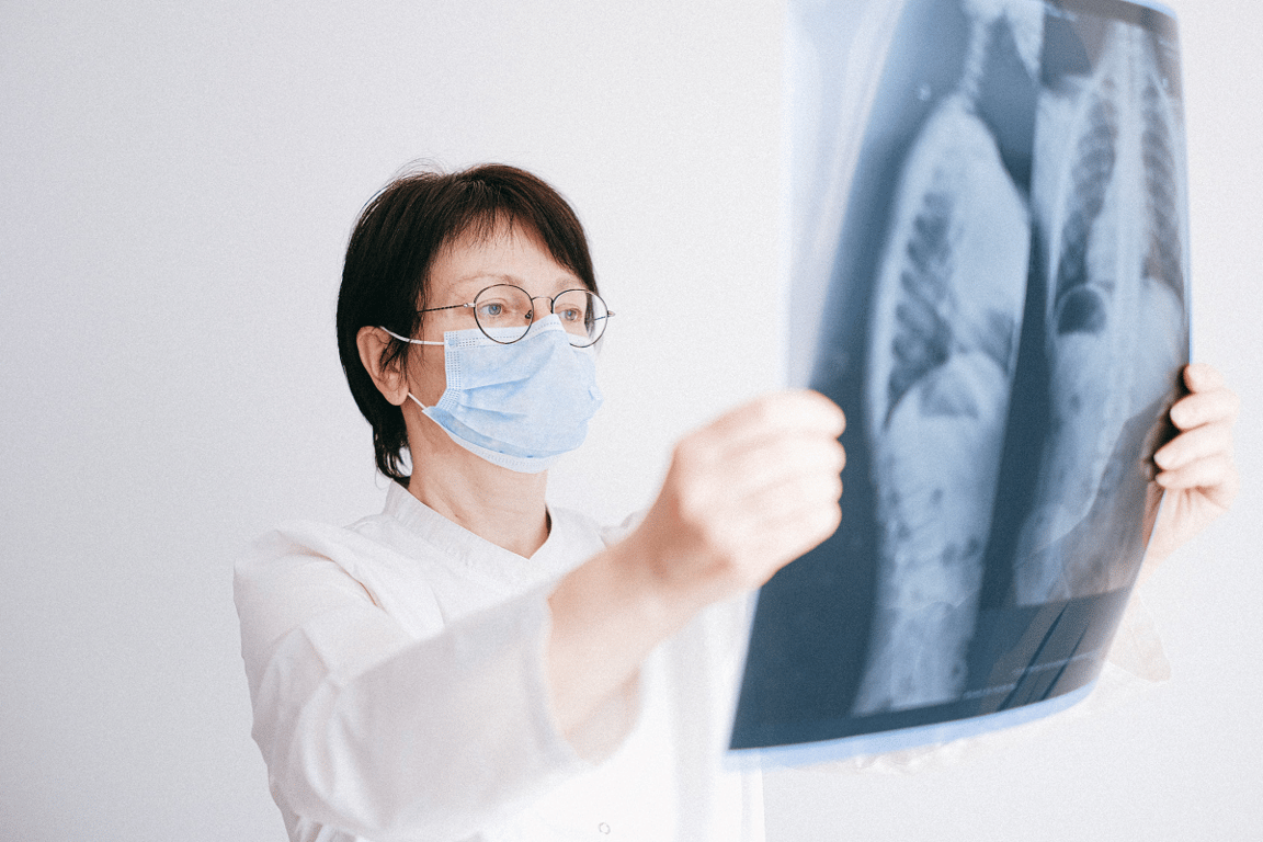 Deset mýtů o rakovině plic, kterým věří většina Čechů. Pravda o této nemoci vás možná překvapí