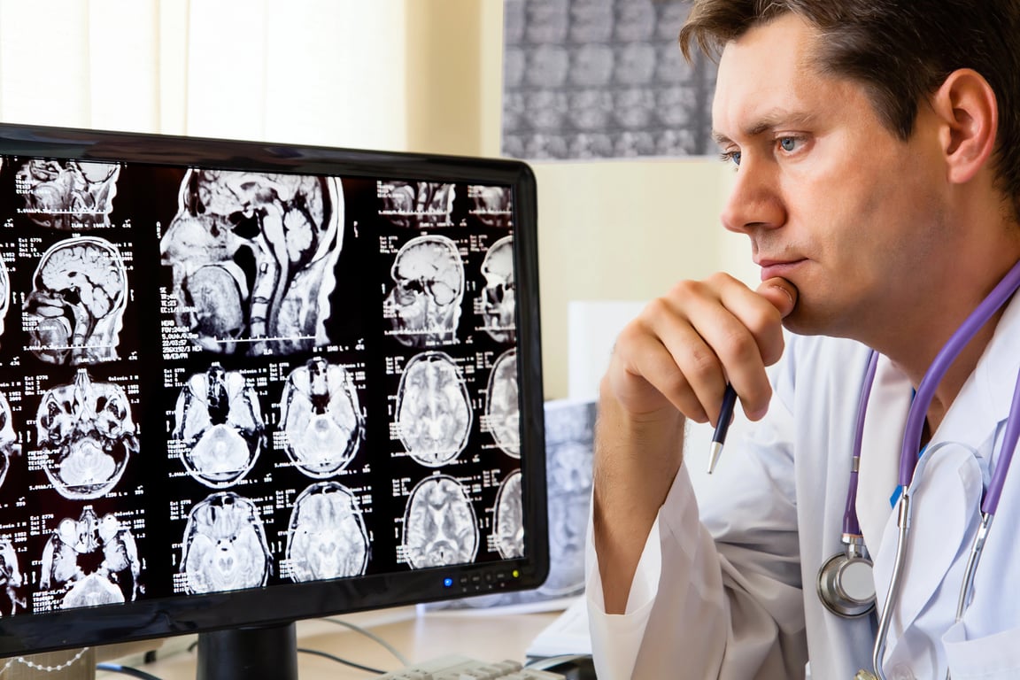 AI jako pomocník lékaře? Cena je mnohem vyšší, než si umíte představit