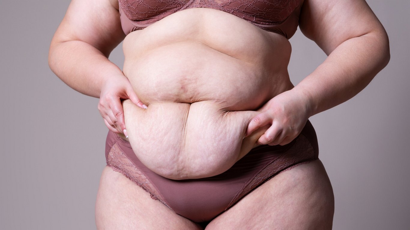 Zhubla 142 kilo a stala se symbolem odhodlání. Nikdo ale netušil, že za její proměnou se skrývá smrtelné riziko