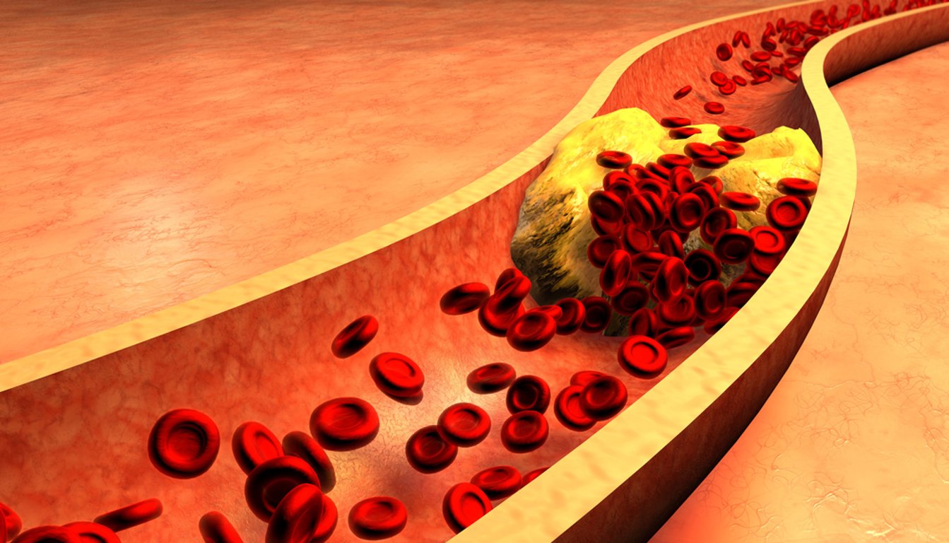 Zvýšený cholesterol se roky nehlásí, pak ale udeří. Některé potraviny ho přitom zvládnou zkrotit během pár dní
