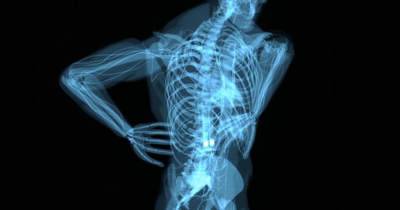 3 potraviny fungují jako anděl strážný, díky kterému ochráníte vaše kosti a vyhnete se osteoporóze