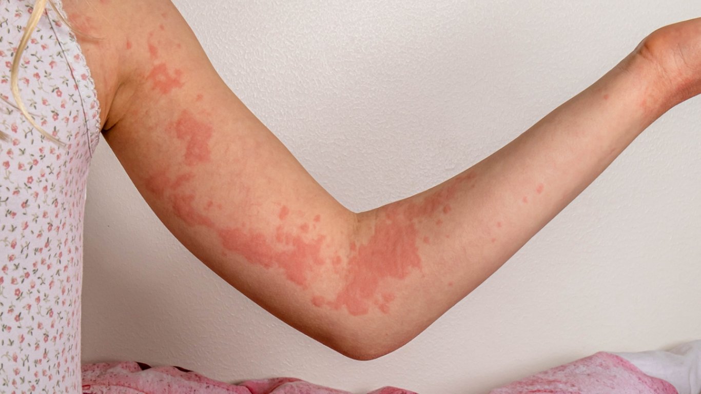 Časná menopauza mění tělo dřív, než si toho žena všimne. První varování většina z nich rozpozná až příliš pozdě