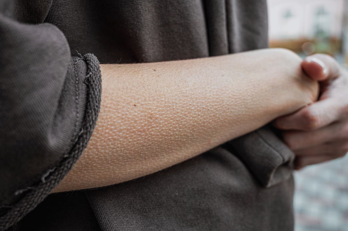 Proč nám naskakuje husí kůže - prastarý reflex, který spouští strach i hudba