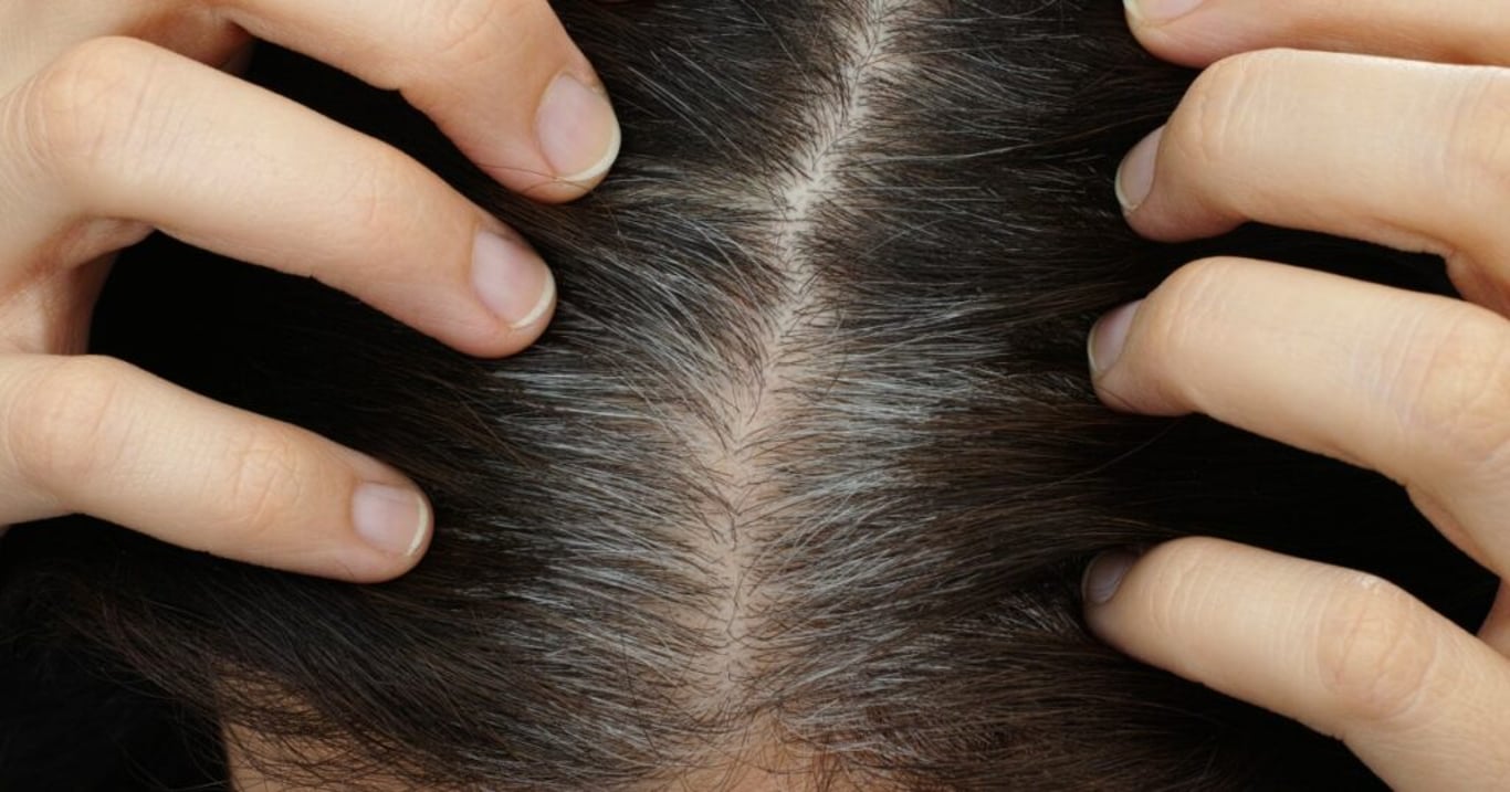 Obnovení růstu vlasů v každém věku: Tato přírodní metoda vás překvapí