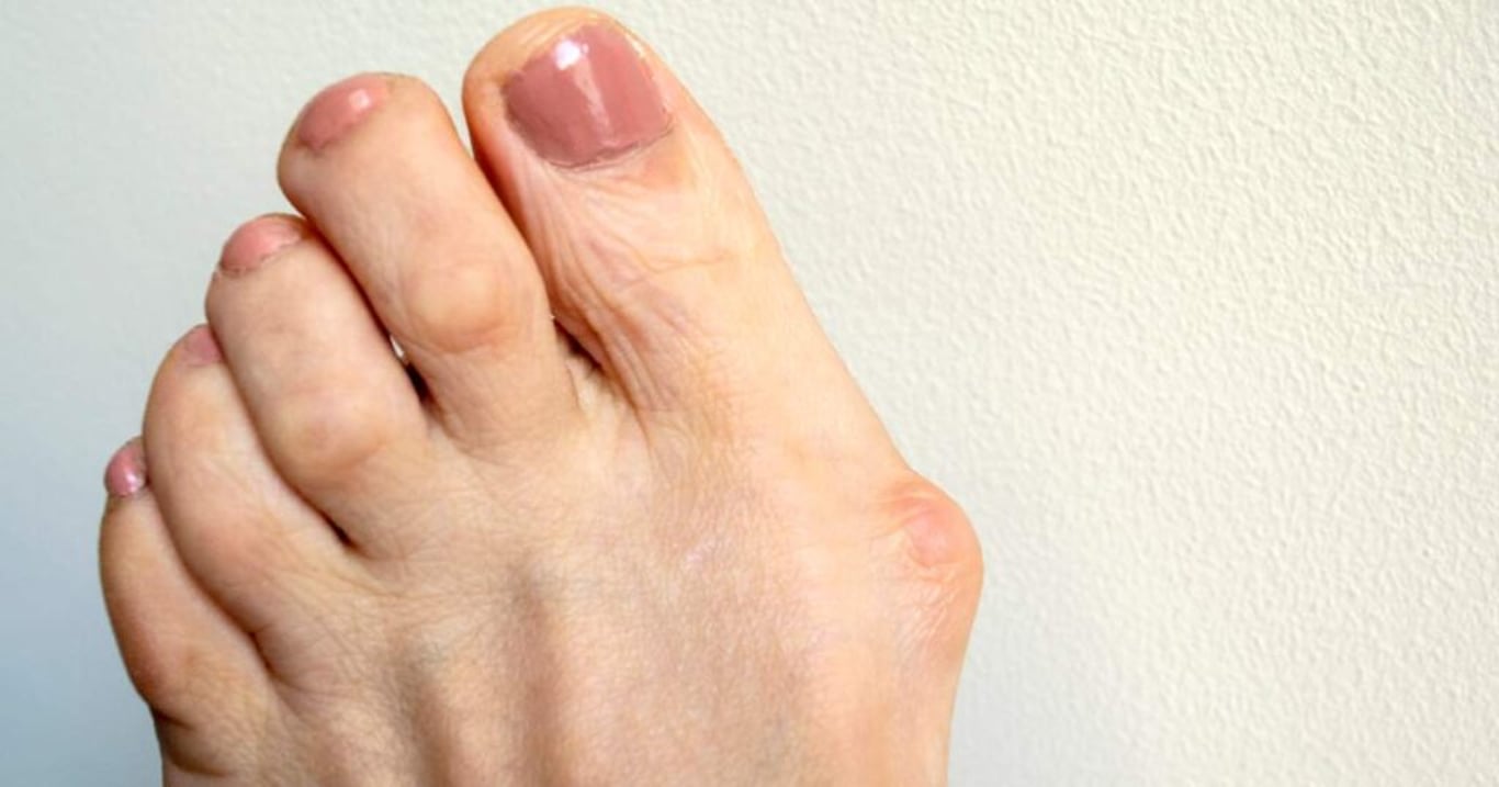 Napravením tohoto častého zlozvyku se najisto vyhnete projevům nebezpečné dny