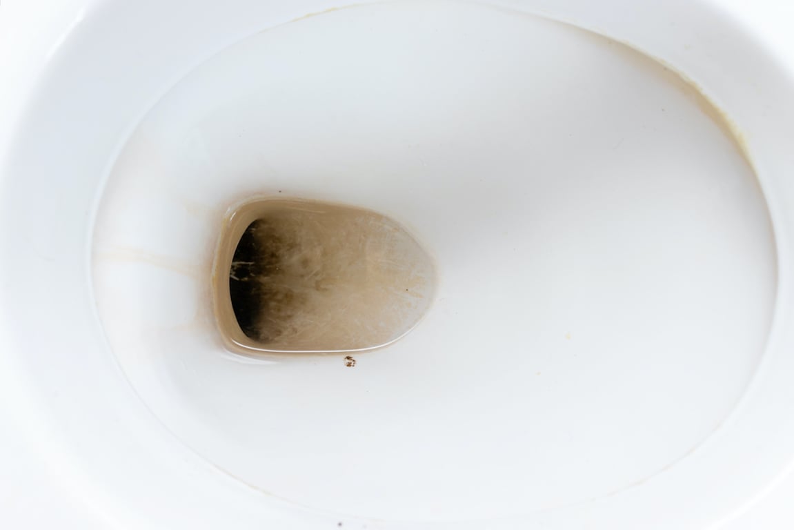 Jaké příznaky má Legionella
