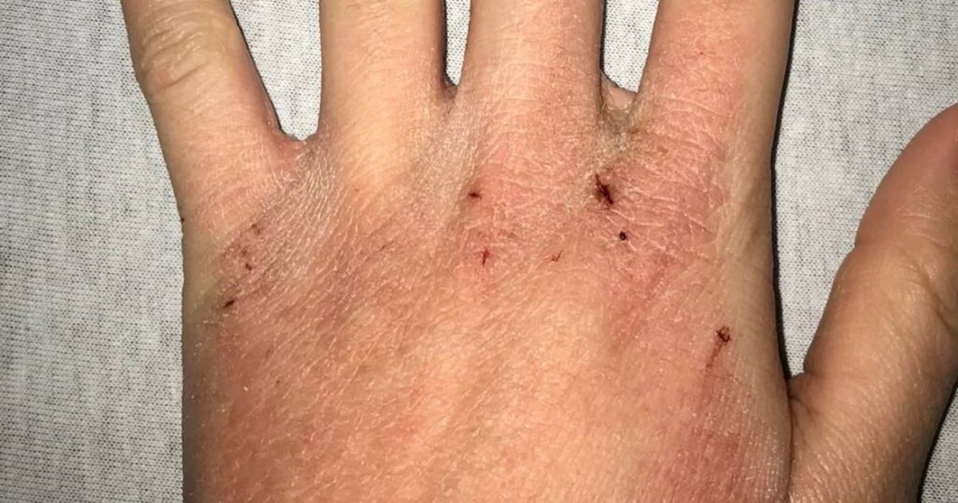 Tyto signály vaše tělo vysílá, když trpíte na extrémní nadbytek toxinů. Nikdy je nepřehlížejte