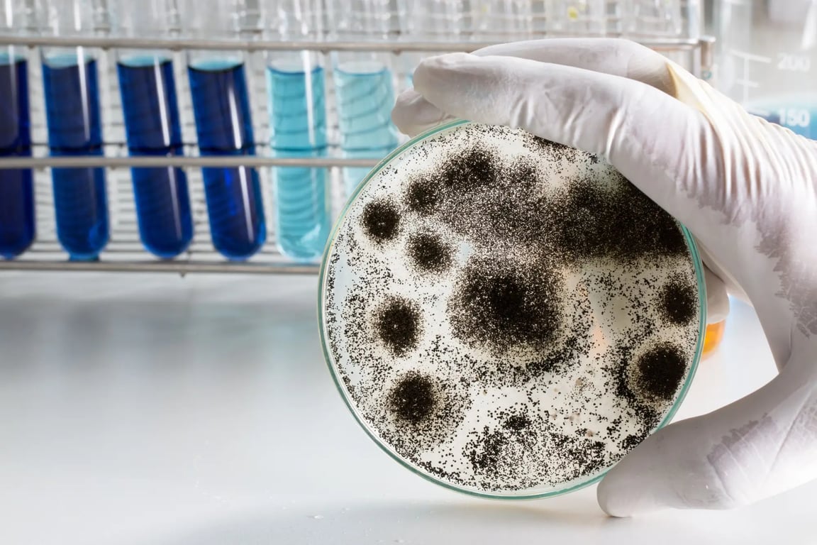 Černá houba rodu Aspergillus pod mikroskopem.