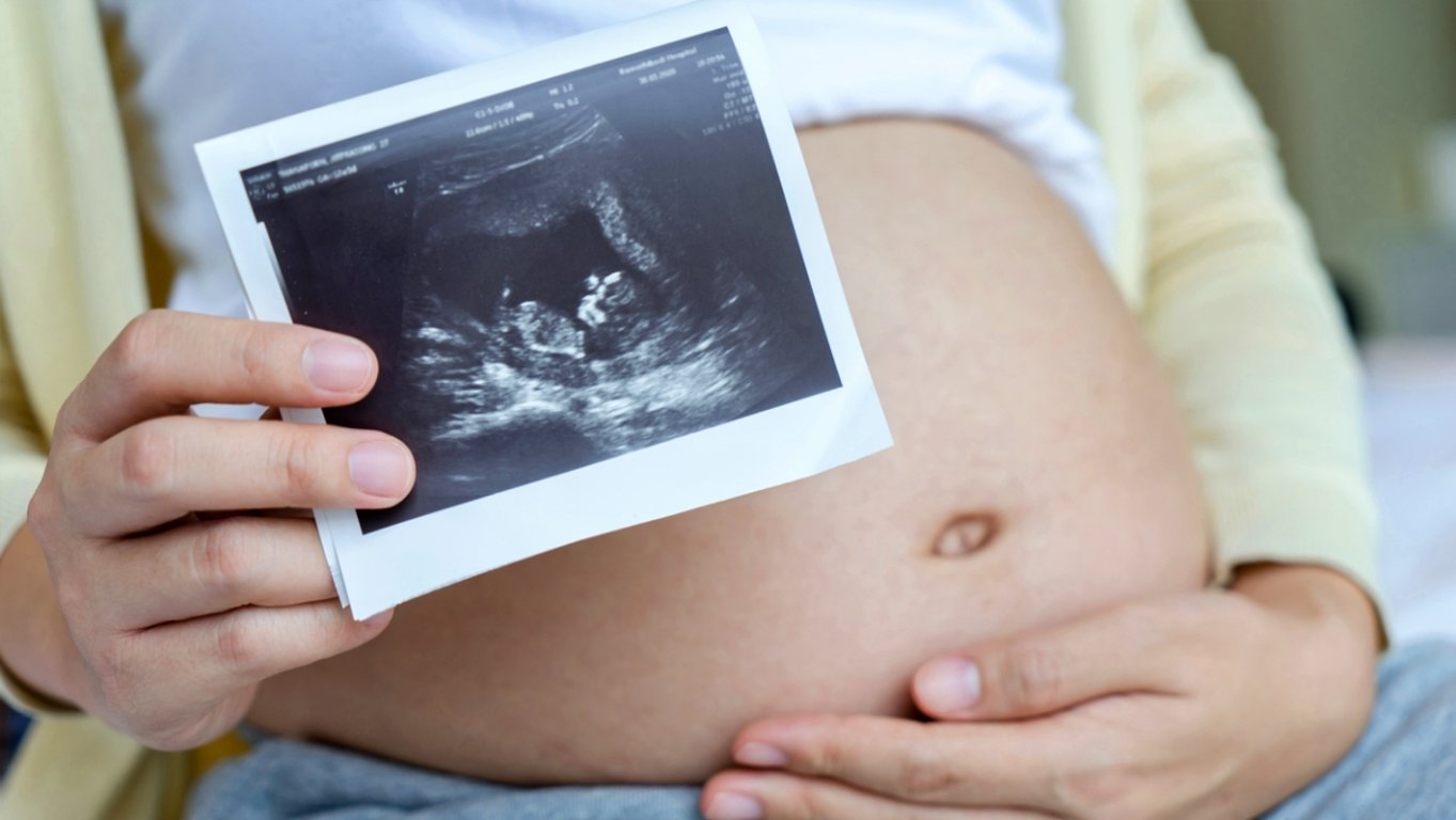 Na ultrazvuku to vypadalo jako obyčejné miminko s vlásky. Skutečnost ale ohromila i zkušené lékaře