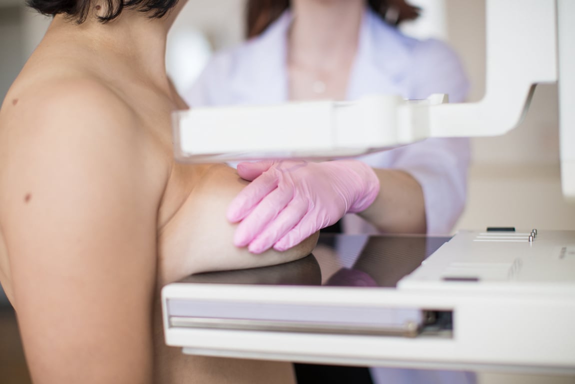 Bolest bradavek bývá nenápadná, ale nebezpečná. Může jít o první znamení vážného problému