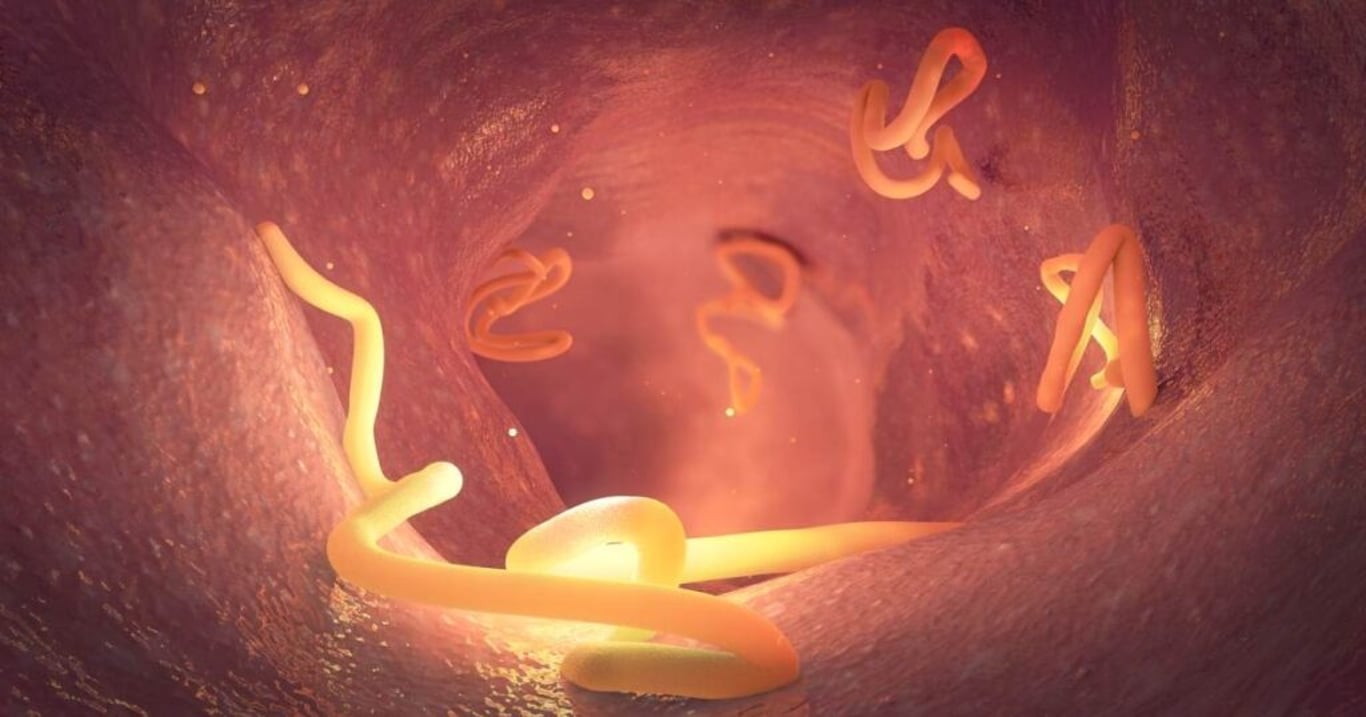 Lékaři se setkávají se stále více pacienty, kteří trpí na tuto parazitární infekci