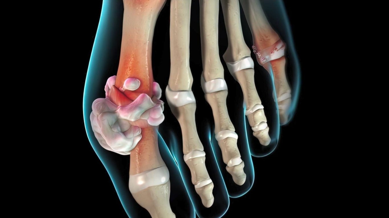 Dna je děsivý strašák, ale vyhnout se jí můžete snadno. Stačí dodržet čtyři jednoduché zásady a nikdy vás nepřekvapí