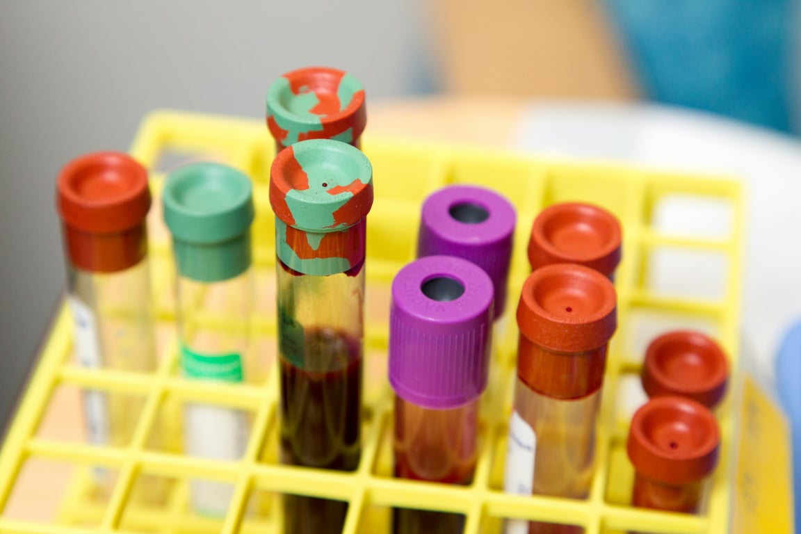 Clear glass test tubes used for lab specimen transport