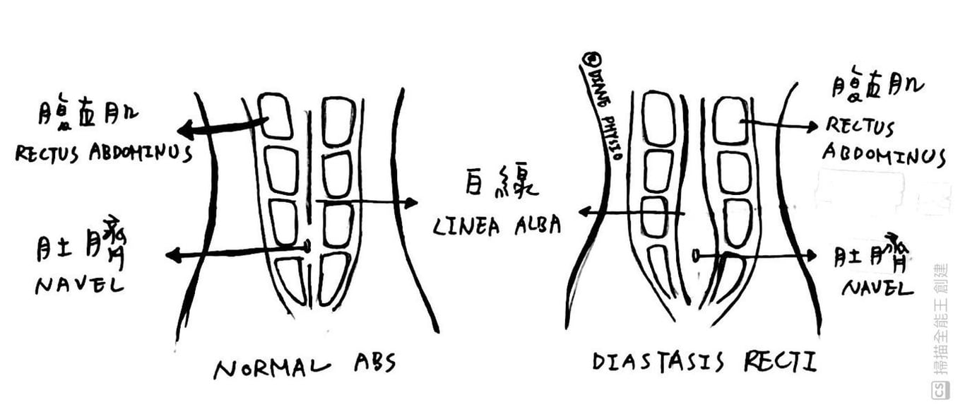 核心肌群怎麼練？ - diane_physio (@fishballcc)