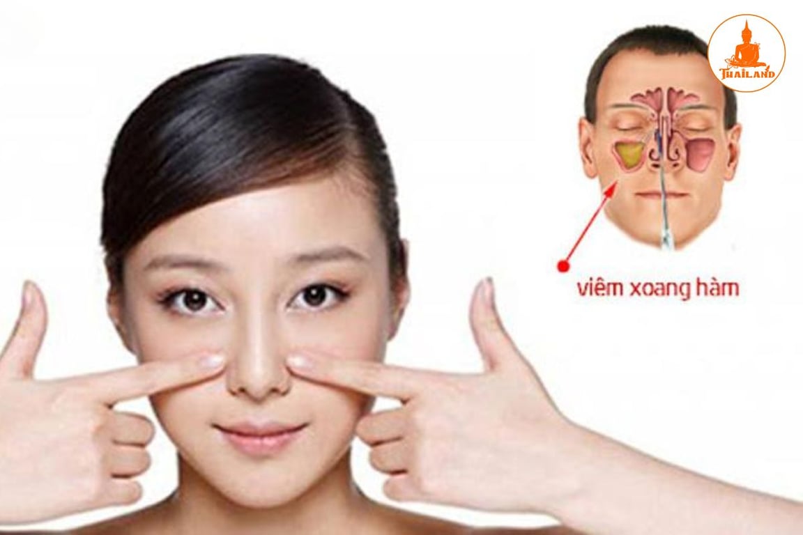 Xoang hàm là hốc xoang lớn nhất trong nhóm xoang mặt, nằm ở khu vực hai bên má