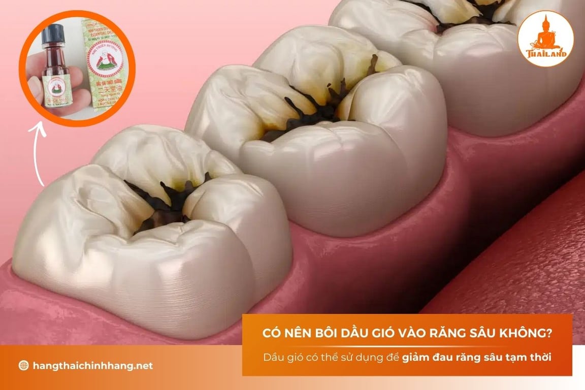 Bôi dầu gió vào răng sâu là một mẹo dân gian được nhiều người áp dụng