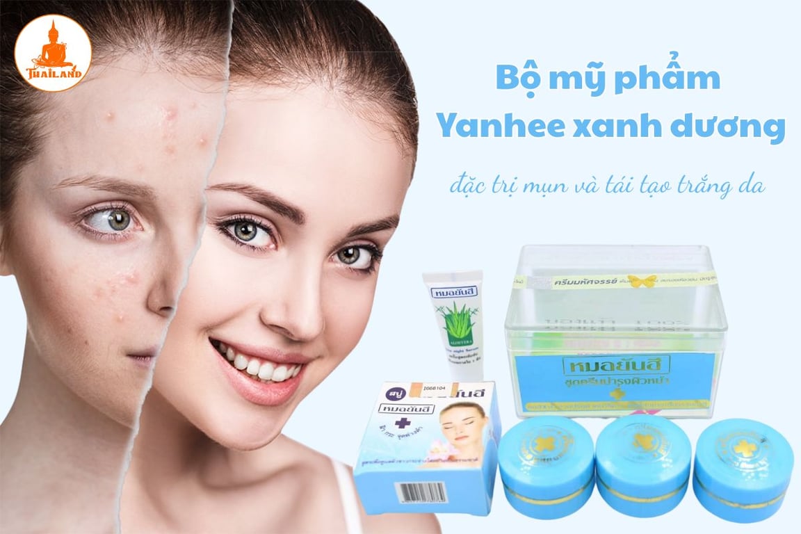 Bộ sản phẩm Yanhee xanh dương mang đến giải pháp toàn diện cho làn da mụn