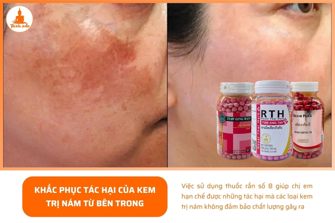 Thuốc rắn số 8 giúp làm giảm sự hình thành và phát triển của nám