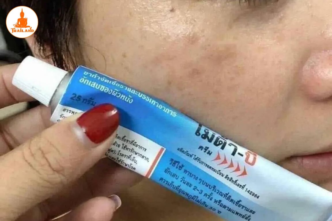 Kem trị nám Myda-B đem lại hiệu quả rõ rệt trong điều trị nám, tàn nhang, lang ben