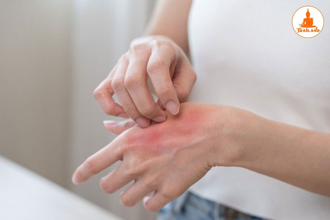việc thoa quá nhiều có thể gây nóng rát, phồng rộp hoặc kích ứng
