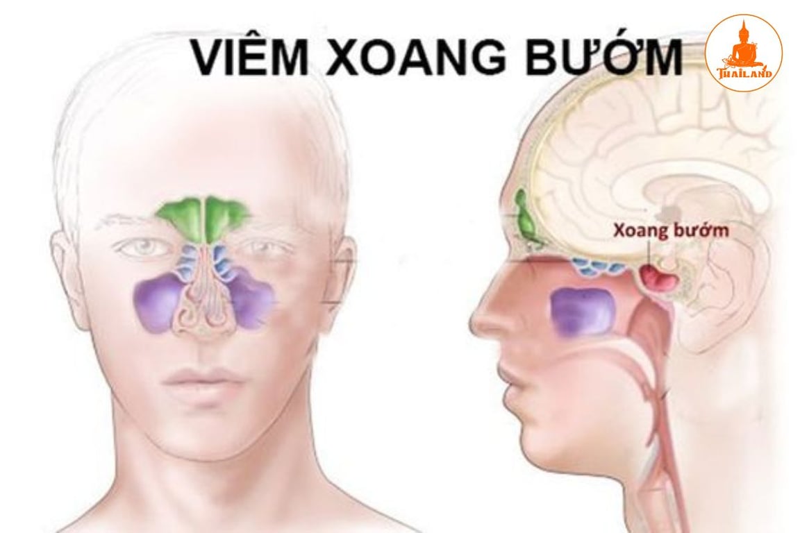 Xoang bướm là xoang nằm sâu nhất trong hệ thống các xoang