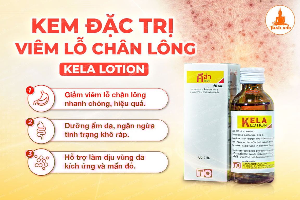 Kela Lotion giúp ức chế sự phát triển của các tác nhân gây viêm nhiễm trong nang lông