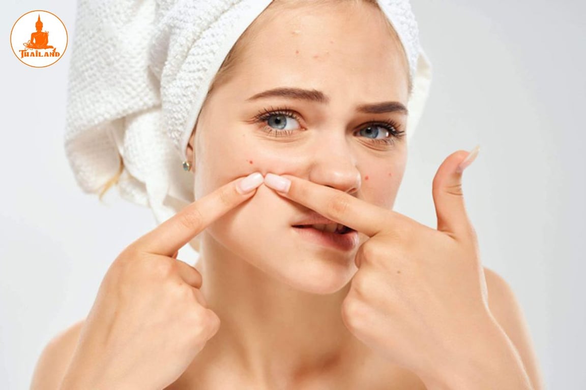 Rối loạn nội tiết tố nữ khiến da dễ nổi mụn hơn