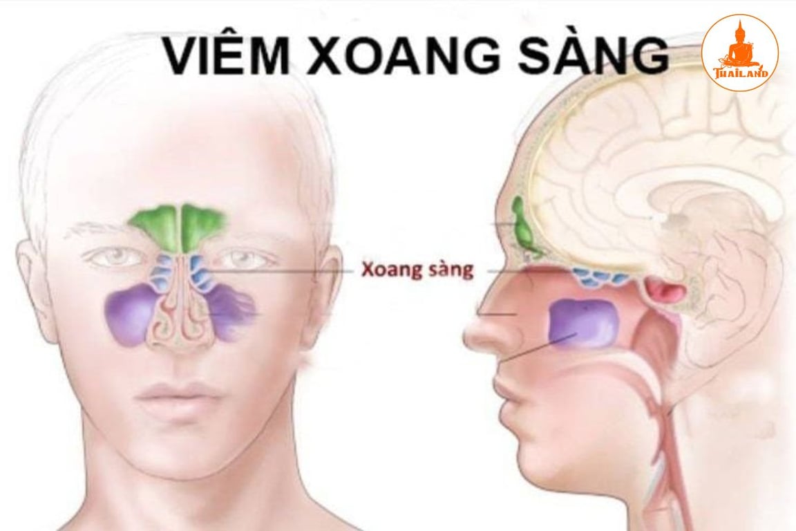 Xoang sàng bao gồm nhiều hốc nhỏ nằm ở vị trí giữa hốc mắt và hốc mũi