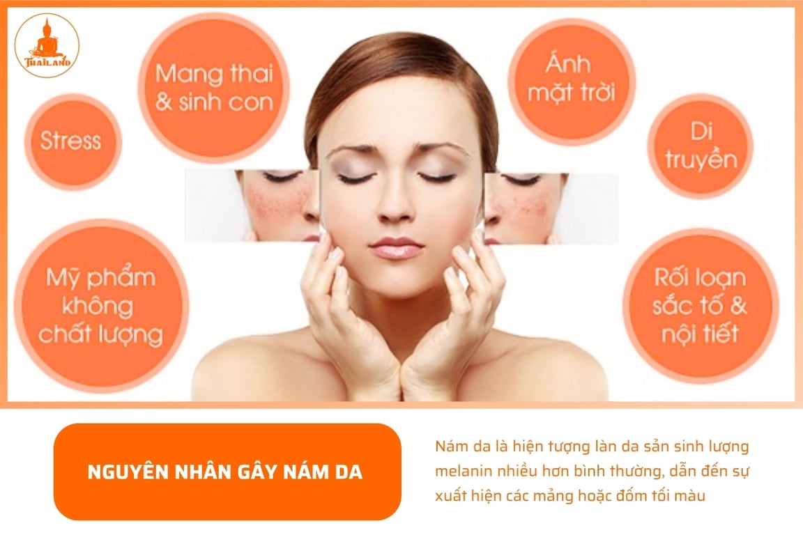 Một trong những yếu tố chính dẫn đến tình trạng nám da là sự biến động của nội tiết tố trong cơ thể