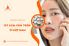 Danh sách 80 loại kem trộn ở Việt Nam mà bạn nên tránh