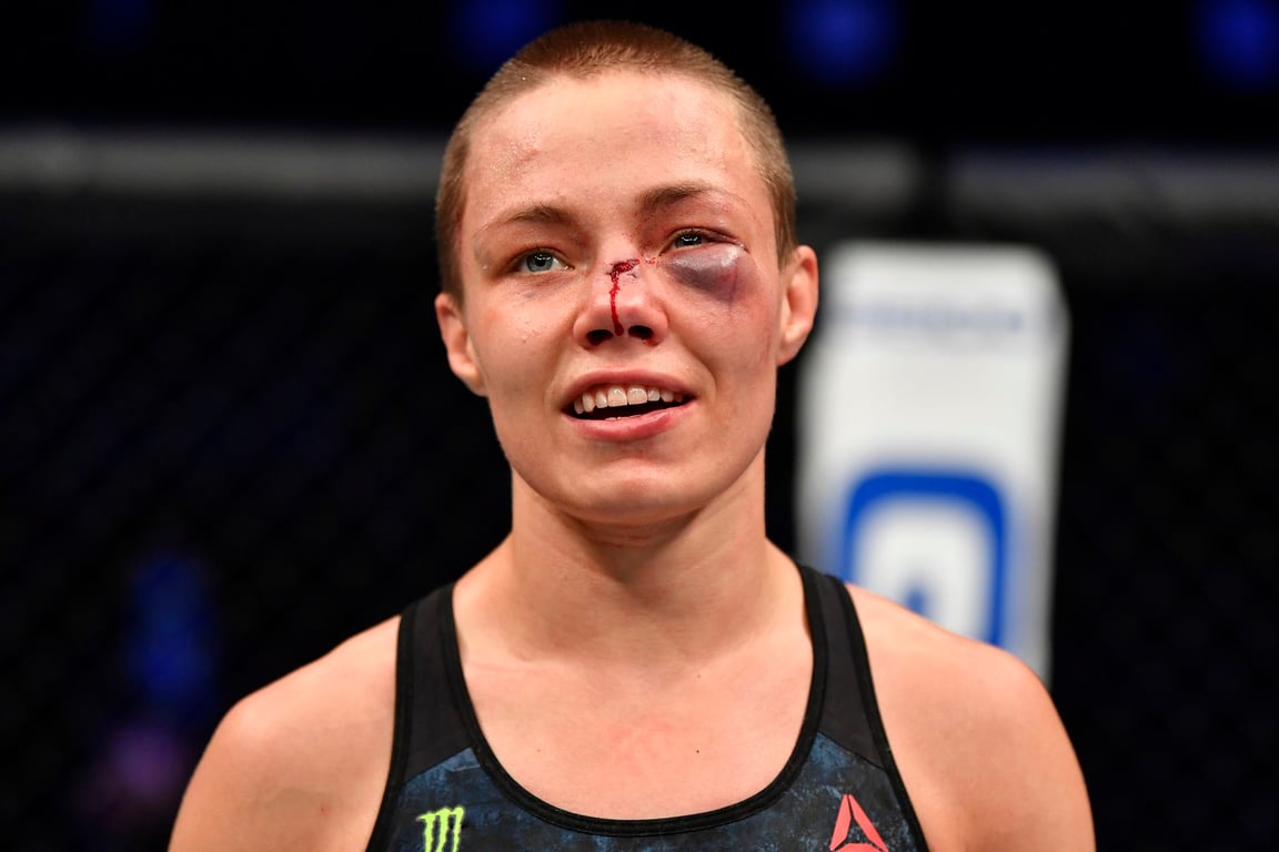 Rose Namajunas after her rematch against Jessica Andrade. Credits to: Jeff Bottari-Zuffa LLC.