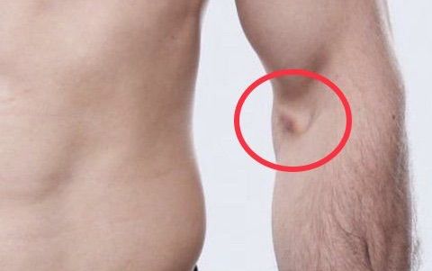 The mark on Islam Makhachev's arm. Credits to: Zuffa LLC
