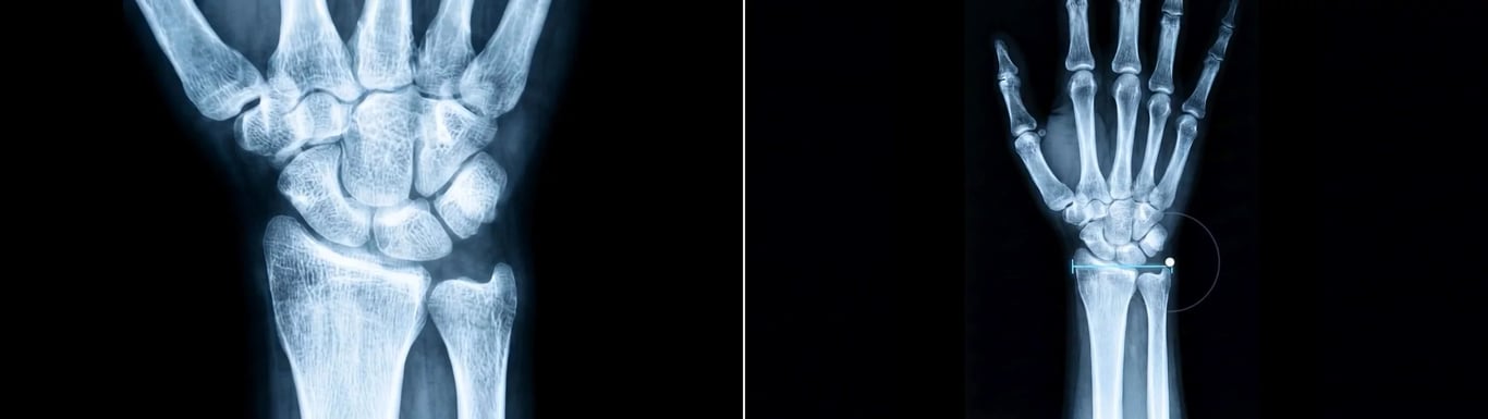 Two Solaris responses produced from the same drag gesture in an X-ray hand interface