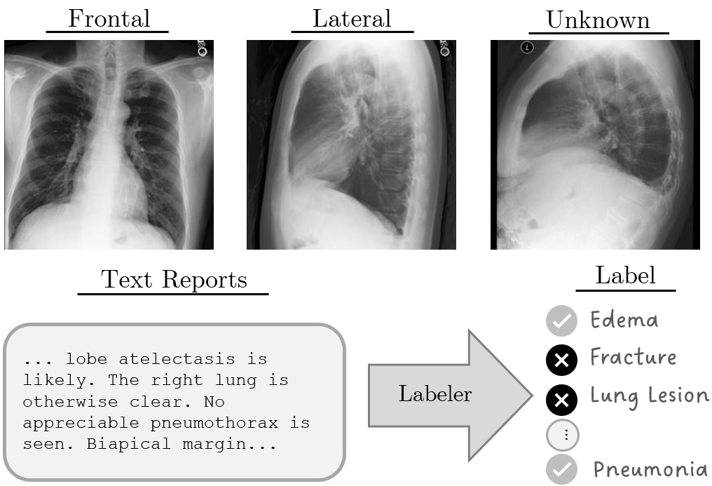 MIMIC-CXR study containing frontal, lateral, and unknown views with its radiology report