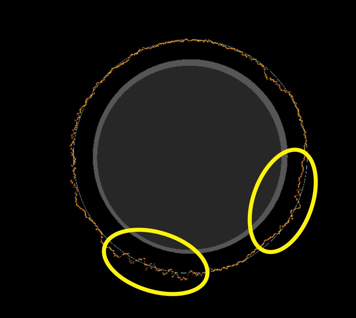 Areas of potential double diamond rings