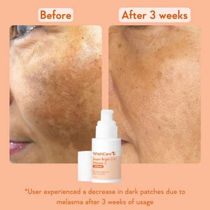 WishCare Super Bright C16 Vitamin C Serum 30ml  •