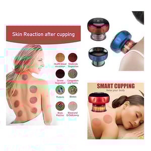 Intelligent Breathing Cupping Massage Instrument - Blue