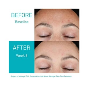 CeraVe Resurfacing Retinol Serum 30ml .