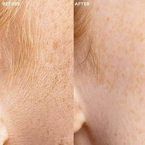 Veet Sensitive Precision Dermaplaning Face Kit