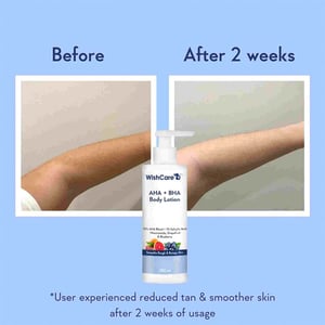 WishCare AHA BHA Body Lotion 200ml •